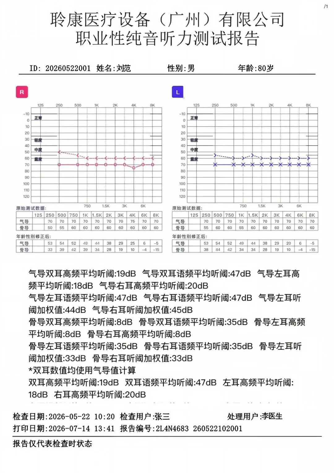 GB 23466‑2025新国标实施｜噪声危害不容忽视，职业听力健康守护刻不容缓(图3)