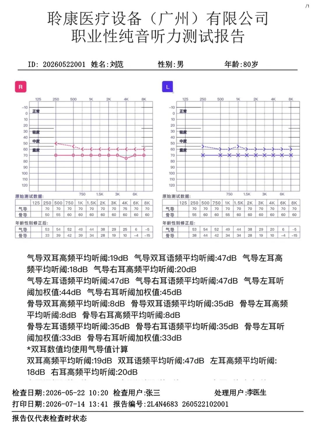 聆康纯音听力计｜职业健康检查/职业病诊断核心优势(图3)