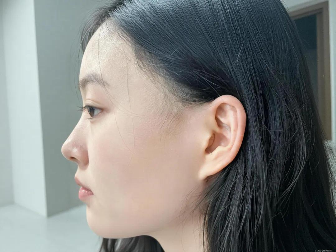 当航天碳纤维遇上大师手作，聆康定制助听器如何“深藏不露”？(图6)