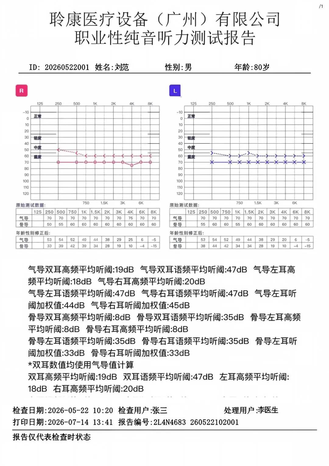 GB 23466‑2025新国标实施|职业听力健康守护刻不容缓(图3)